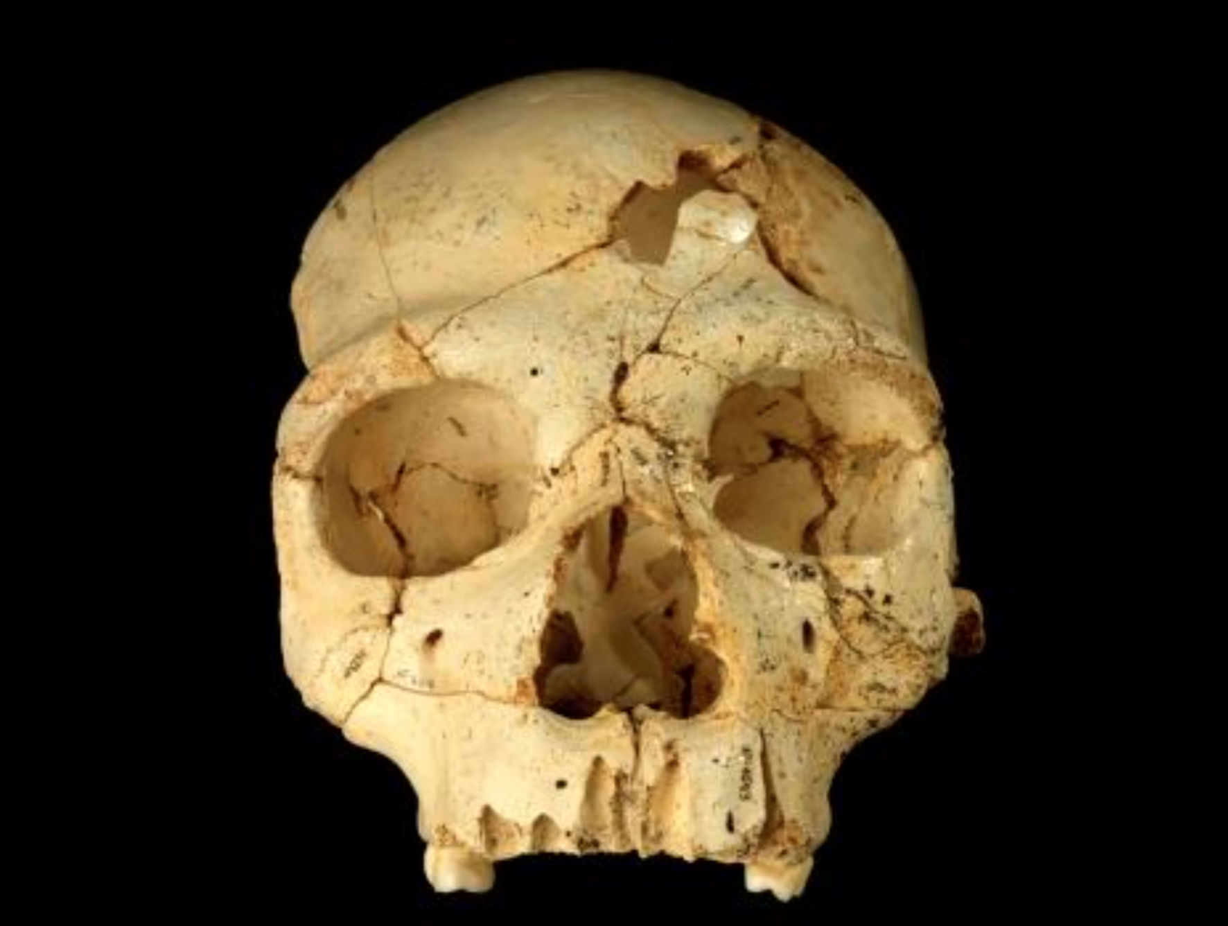 FORENSIC PALEOANTHROPOLOGY